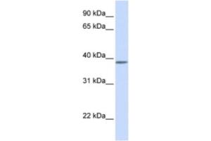 Western Blotting (WB) image for anti-Kruppel-Like Factor 8 (KLF8) antibody (ABIN2460594) (KLF8 antibody)