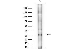 anti-Eukaryotic Translation Initiation Factor 6 (EIF6) (C-Term) antibody