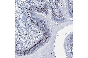 Immunohistochemical staining of human bronchus with MFSD5 polyclonal antibody  shows strong nuclear positivity in respiratory epithelial cells. (MFSD5 antibody)