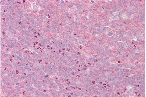 GRIPAP1 antibody  (N-Term)