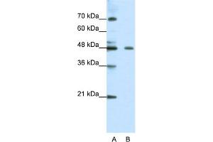 WB Suggested Anti-ZNF645 Antibody Titration:  0.