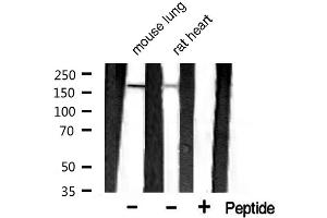 Western blot analysis of extracts of various celllines,using MAP2 antibody. (MAP2 antibody  (N-Term))