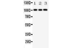 Anti-MCK10 antibody, Western blotting Lane 1: A431 Cell Lysate Lane 2: A549 Cell Lysate Lane 3: HELA Cell Lysate
