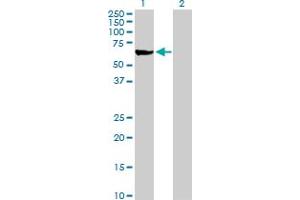 Western Blot analysis of ME1 expression in transfected 293T cell line by ME1 MaxPab polyclonal antibody. (ME1 antibody  (AA 1-572))