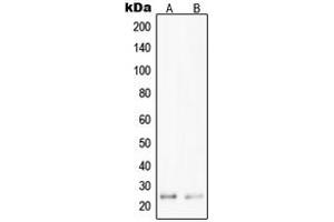Western blot analysis of PPP1R14D expression in Jurkat (A), HepG2 (B) whole cell lysates. (PPP1R14D antibody  (Center))