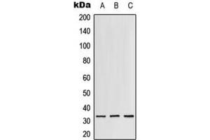 Western blot analysis of RPS3 expression in Jurkat (A), mouse liver (B), rat lung (C) whole cell lysates.