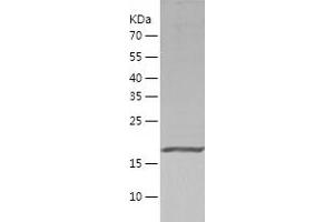 Western Blotting (WB) image for Peroxiredoxin 2 (PRDX2) (AA 1-198) protein (His tag) (ABIN7124361) (Peroxiredoxin 2 Protein (PRDX2) (AA 1-198) (His tag))