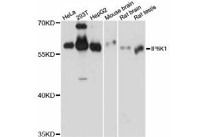 Western blot analysis of extracts of various cell lines, using IP6K1 antibody (ABIN6293094) at 1:1000 dilution. (IP6K1 antibody)