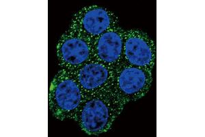 Immunofluorescence (IF) image for anti-Succinate Dehydrogenase Complex, Subunit D, Integral Membrane Protein (SDHD) antibody (ABIN2996554) (SDHD antibody)