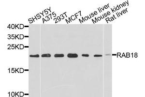 Western blot analysis of extracts of various cell lines, using RAB18 antibody (ABIN5971481) at 1/1000 dilution.