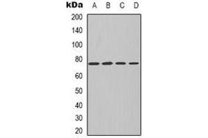 Western blot analysis of PKC iota/zeta expression in MCF7 (A), NIH3T3 (B), mouse kidney (C), rat kidney (D) whole cell lysates. (PKC iota/zeta antibody)