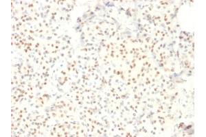 Immunohistochemistry (IHC) image for anti-LIM Domain Only 2 (Rhombotin-Like 1) (LMO2) (AA 23-140) antibody (ABIN6939966)