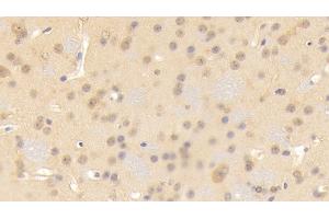 Detection of CNTN3 in Mouse Cerebrum Tissue using Polyclonal Antibody to Contactin 3 (CNTN3) (CNTN3 antibody  (AA 264-493))