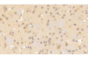 Detection of CNTN3 in Mouse Cerebrum Tissue using Polyclonal Antibody to Contactin 3 (CNTN3)