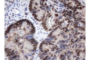 Image no. 2 for anti-Methyltransferase Like 16 (METTL16) antibody (ABIN1499432) (METTL16 antibody)