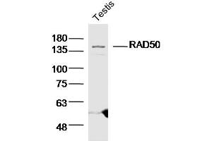 Mouse testis lysates probed with RAD50 Polyclonal Antibody  at 1:300 overnight at 4°C followed by a conjugated secondary antibody for 60 minutes at 37°C. (RAD50 antibody  (AA 817-872))