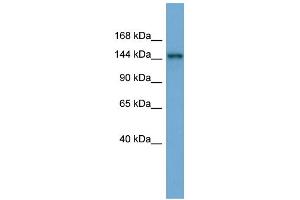 WB Suggested Anti-TEX14 Antibody Titration: 0. (TEX14 antibody  (Middle Region))