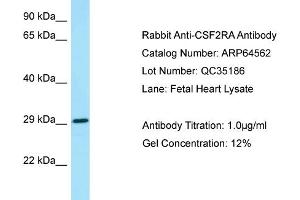 Western Blotting (WB) image for anti-Colony Stimulating Factor 2 Receptor, Alpha, Low-Affinity (Granulocyte-Macrophage) (CSF2RA) (N-Term) antibody (ABIN2789878) (CSF2RA antibody  (N-Term))