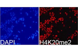 Immunofluorescence analysis of 293T cells using Dimethyl-Histone H4-K20 antibody (ABIN5969818). (Histone H4 antibody  (2meLys20))
