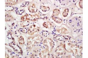 Formalin-fixed and paraffin embedded human kidney labeled with Anti-PDSS2 Polyclonal Antibody, Unconjugated (ABIN1386354) at 1:200 followed by conjugation to the secondary antibody and DAB staining (PDSS2 antibody  (AA 21-100))