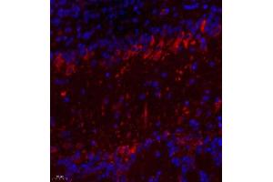 Immunofluorescence of paraffin embedded mouse prefrontal lobe using TTC33 (ABIN7075871) at dilution of 1: 650 (400x lens) (TTC33 antibody)