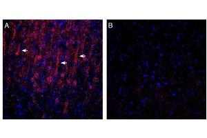 Expression of GPR183 in in rat parietal cortex. (GPR183 antibody  (Extracellular))