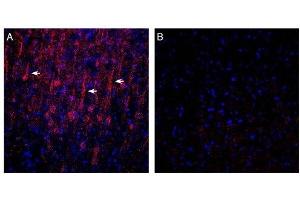 Expression of GPR183 in in rat parietal cortex. (GPR183 antibody  (Extracellular, N-Term))