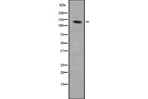 Western blot analysis of AEBP1 expression in HEK293 cells ,The lane on the left is treated with the antigen-specific peptide. (AEBP1 antibody  (N-Term))