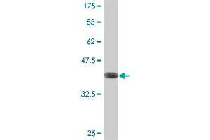 Western Blot detection against Immunogen (37 KDa) . (TSEN34 antibody  (AA 1-99))