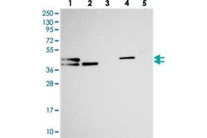 Western blot analysis of Lane 1: RT-4, Lane 2: U-251 MG, Lane 3: Human Plasma, Lane 4: Liver, Lane 5: Tonsil with CHID1 polyclonal antibody . (CHID1 antibody)
