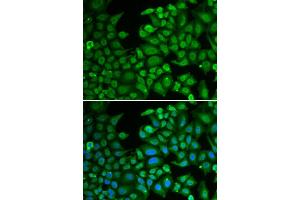 Immunofluorescence analysis of MCF-7 cells using RBFOX3 antibody (ABIN5970347).