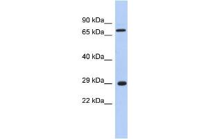 Human Muscle; WB Suggested Anti-AKTIP Antibody Titration: 0. (AKTIP antibody  (Middle Region))