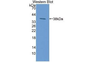 Western blot analysis of the recombinant protein. (LPO antibody)