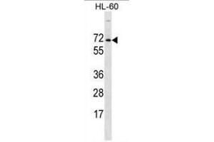 ACPL2 Antibody (Center) western blot analysis in HL-60 cell line lysates (35 µg/lane). (ACPL2 antibody  (Middle Region))