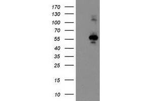 HEK293T cells were transfected with the pCMV6-ENTRY control (Left lane) or pCMV6-ENTRY CCM2 (Right lane) cDNA for 48 hrs and lysed. (CCM2 antibody)