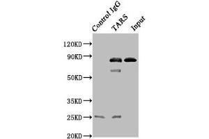 Immunoprecipitating TARS in A549 whole cell lysate Lane 1: Rabbit control IgG instead of ABIN7172077 in A549 whole cell lysate. (TARS antibody  (AA 1-230))