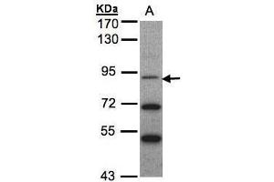 WB Image Sample(30 ug whole cell lysate) A:MOLT4 , 7. (NTRK3 antibody  (Internal Region))