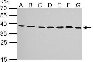 WB Image JAM-B antibody detects JAM2 protein by Western blot analysis.