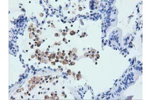 Immunohistochemistry (IHC) image for anti-rho GTPase Activating Protein 25 (ARHGAP25) antibody (ABIN1496701) (ARHGAP25 antibody)