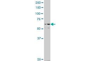 TNK2 polyclonal antibody (A01), Lot # 051109JC01 Western Blot analysis of TNK2 expression in Y-79 . (TNK2 antibody  (AA 21-120))
