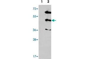 Western blot analysis of MAPK12 (arrow) using MAPK12 polyclonal antibody .