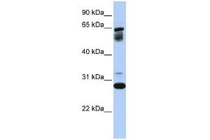 TMEM187 antibody used at 1 ug/ml to detect target protein. (TMEM187 antibody  (Middle Region))