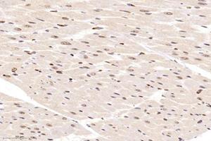 Immunohistochemistry analysis of paraffin-embedded rat heart using,ZBTB20 (ABIN7076248) at dilution of 1: 12000 (ZBTB20 antibody)
