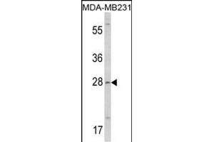 Western blot analysis of COLEC11 Antibody (N-term) (ABIN390822 and ABIN2841053) in MDA-M cell line lysates (35 μg/lane). (COLEC11 antibody  (N-Term))