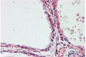Human Thyroid: Formalin-Fixed, Paraffin-Embedded (FFPE) (Aconitase 1 antibody  (N-Term))
