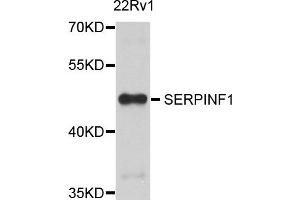 Western blot analysis of extract of 22Rv1 cells, using SERPINF1 antibody.