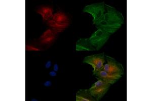 ABIN6264942 and ABIN6279840 staining  cells by IF/ICC.