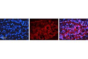 Rabbit Anti-NFKBIB Antibody   Formalin Fixed Paraffin Embedded Tissue: Human Testis Tissue Observed Staining: Nucleus, Cytoplasm Primary Antibody Concentration: 1:100 Other Working Concentrations: N/A Secondary Antibody: Donkey anti-Rabbit-Cy3 Secondary Antibody Concentration: 1:200 Magnification: 20X Exposure Time: 0. (NFKBIB antibody  (Middle Region))