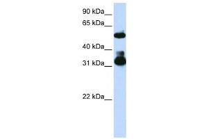 Western Blotting (WB) image for anti-F-Box and WD Repeat Domain Containing 2 (FBXW2) antibody (ABIN2458706) (FBXW2 antibody)
