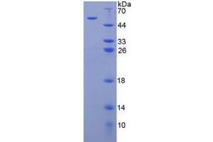 Image no. 1 for Arylsulfatase B (ARSB) (AA 81-533) (Active) protein (His tag) (ABIN6239887)